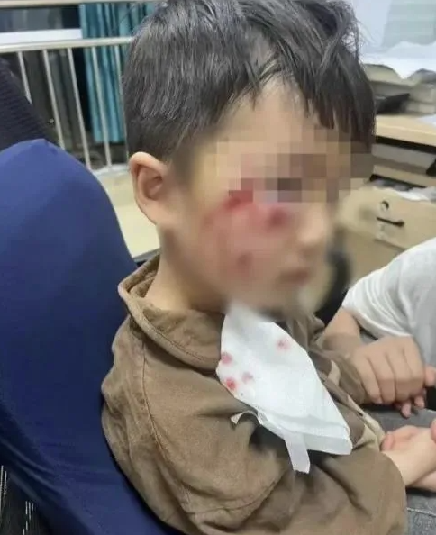 被瘋?cè)麤](méi)有“救命藥”，怎么辦？